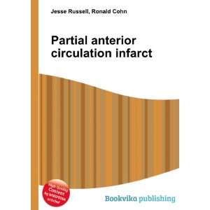  Partial anterior circulation infarct Ronald Cohn Jesse 